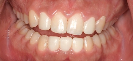 smile gallery image