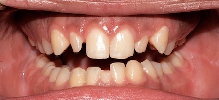 smile gallery image