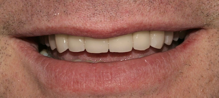smile gallery image