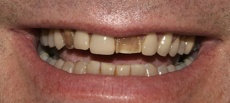 smile gallery image