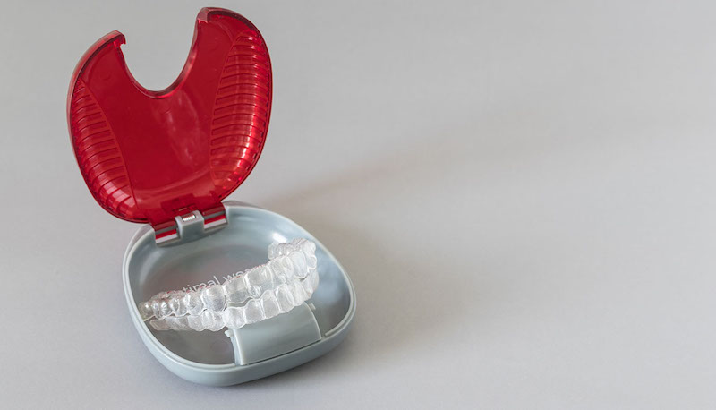 Invisalign2